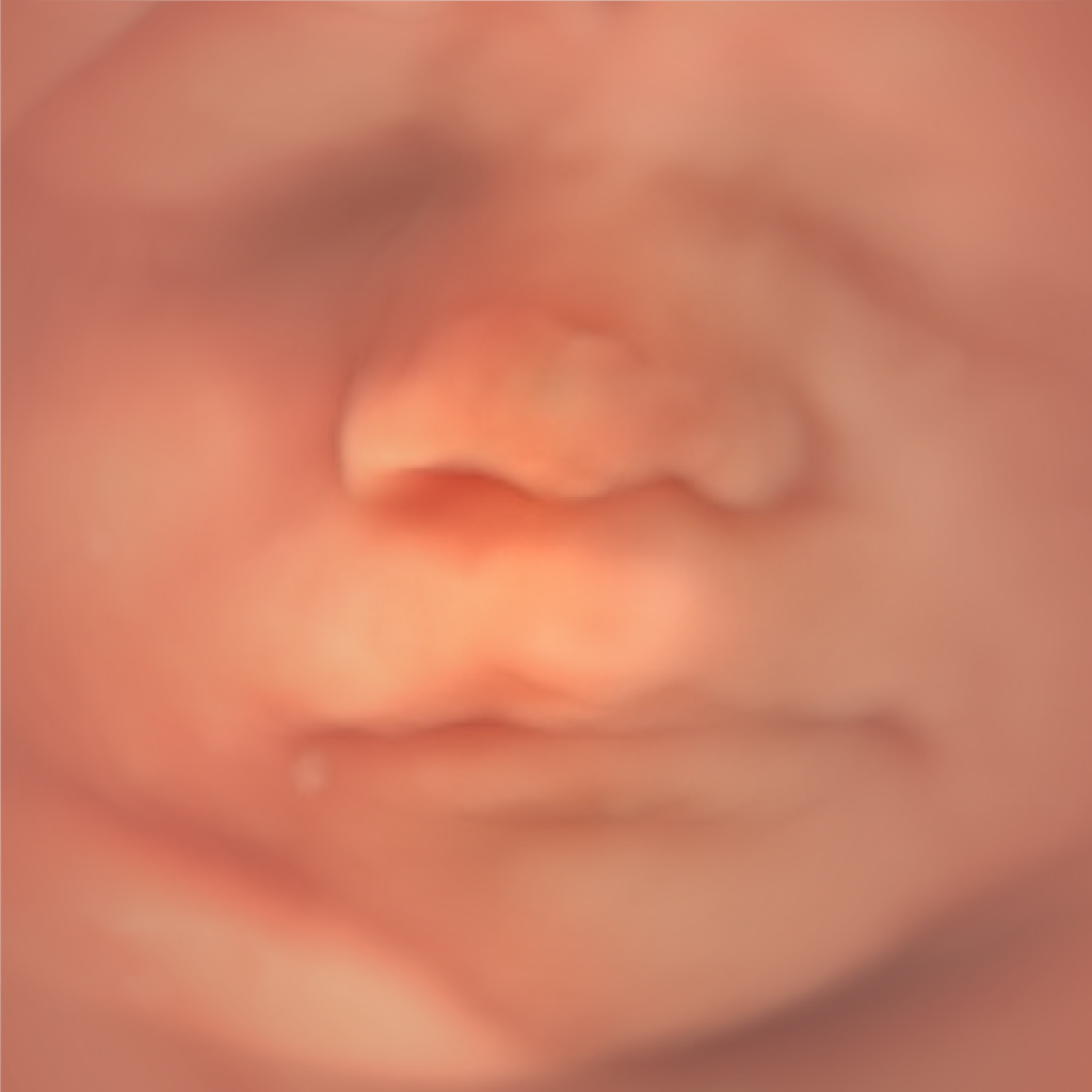 photo echographie bebe