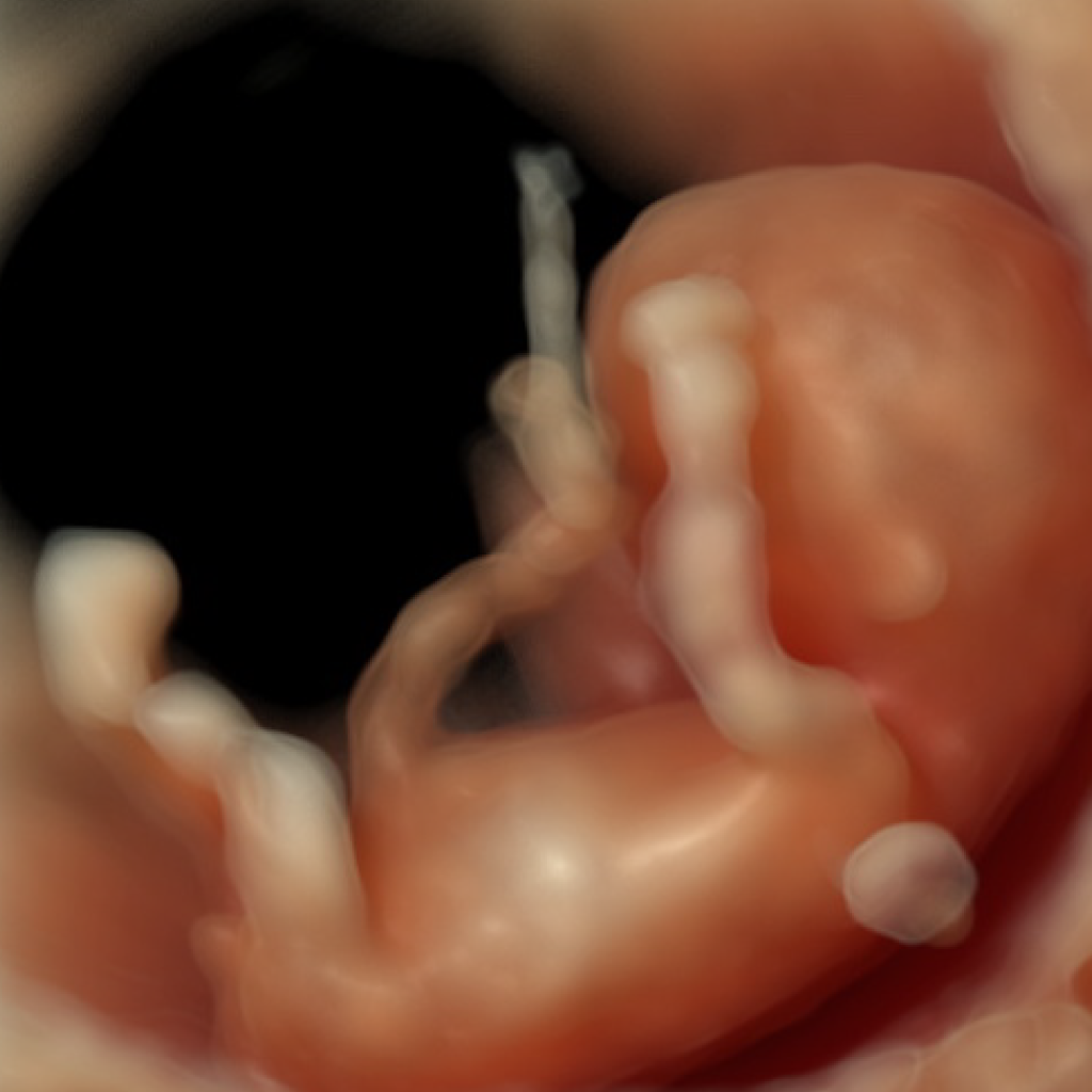 photo echographie bebe 2