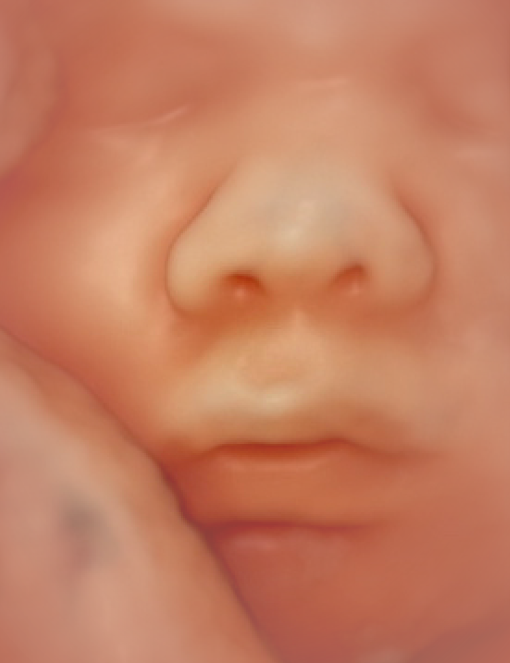 photo echographie bebe 5